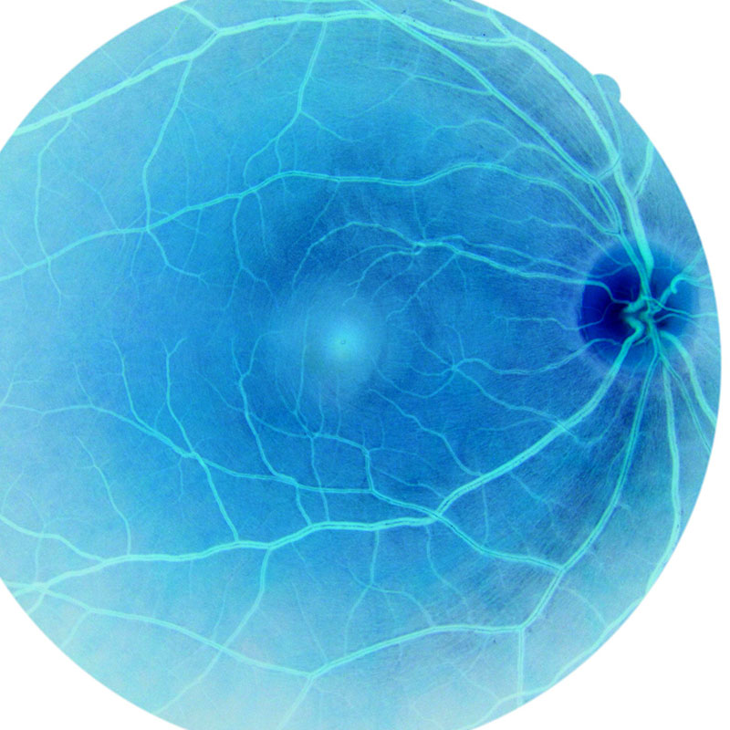 alcon_eye_SP