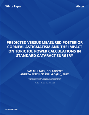 Predicted Versus Measured Posterior Corneal Astigmatism and the Impact on Toric IOL Power Calculations in Standard Cataract Surgery