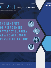 The Importance of Maintaining a Lower, More Physiological IOP During Cataract Surgery 