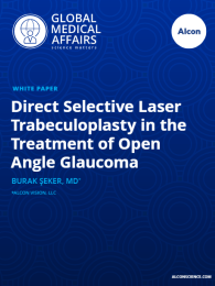 Direct Selective Laser Trabeculoplasty in the Treatment of Open Angle Glaucoma