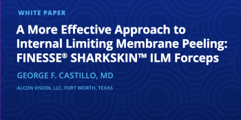A More Effective Approach to Internal Limiting Membrane Peeling