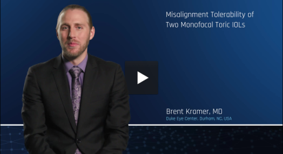 Misalignment Tolerability of Two Monofocal Toric IOLs - image