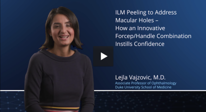 ILM Peeling to Address Macular Holes - How an Innovative Forcep/Handle Combination Instills Confidence
