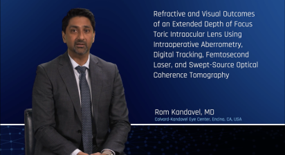 Refractive and Visual Outcomes of an Extended Depth of Focus Toric Intraocular Lens Using Intraoperative, aberrometry, Digital Tracking, Femtosecond Laser, and Swept-Source Optical Coherence Tomography