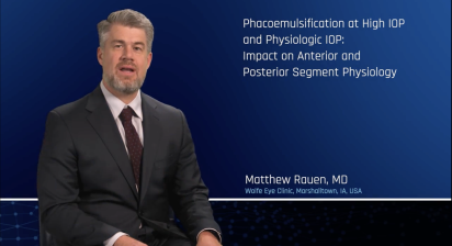 Phacoemulsification at High IOP and Physiologic IOP; Impact on Anterior and Posterior Segment Physiology