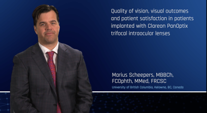 Quality of vision, visual outcomes and patient satisfaction in patients implanted with Clareon PanOptix trifocal intraocular lenses
