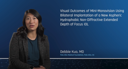 Visual Outcomes of Mini-Monovision Using Bilateral Implantation of a New Aspheric Hydrophobic Non-Diffractive Extended Depth of Focus IOL